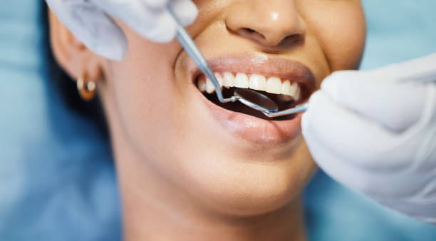 Best Urgent Tooth Repair  in Moultrie, GA